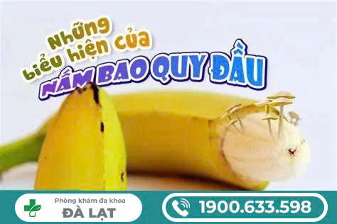 Hình ảnh minh họa